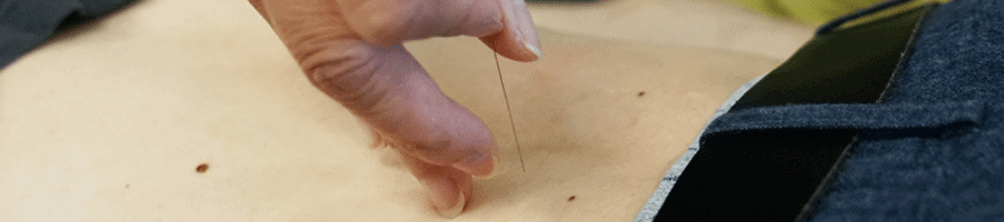 Formation acupuncture et tui na