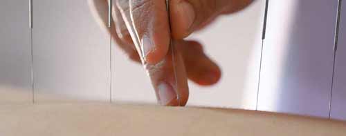 Stage superviser des cas cliniques acupuncture et tuina
